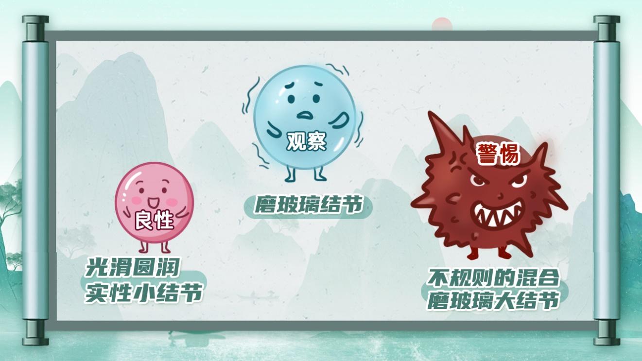 体检单上出现“肺结节”就是得了癌？ 专家说：90%都是虚惊一场