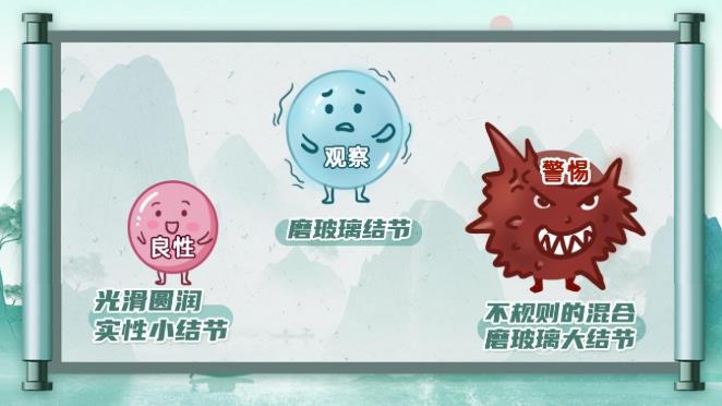 体检单上出现“肺结节”就是得了癌？ 专家说：90%都是虚惊一场